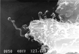 wNanobes observés par Microscopie électronique