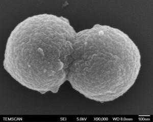 Cellules d’Archées de Thermococcus kodakaraensis en division. Crédits photo : E.Marguet, P.Forterre, Institut de Génétique et Microbiologie, Université Paris-Sud et I.Fourquaux, S.le Blond du Plouy Centre de Microscopie Electronique Appliquée à la Biologie, Faculté de Médecine Rangueil, Toulouse.