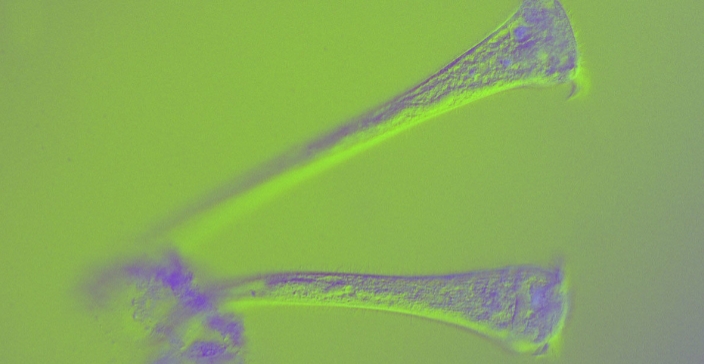 CETTE CRÉATURE UNICELLULAIRE EST ÉTRANGEMENT INTELLIGENTE